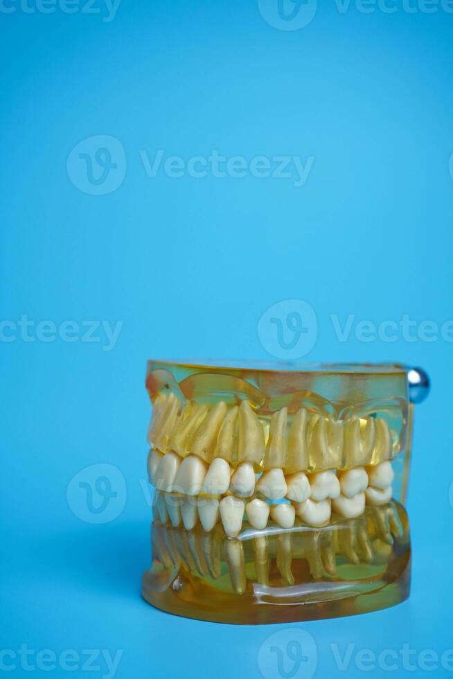 kunstgebit Aan een blauw achtergrond.boven en lager kaken met false tanden. kunstgebit of false tanden, detailopname. foto