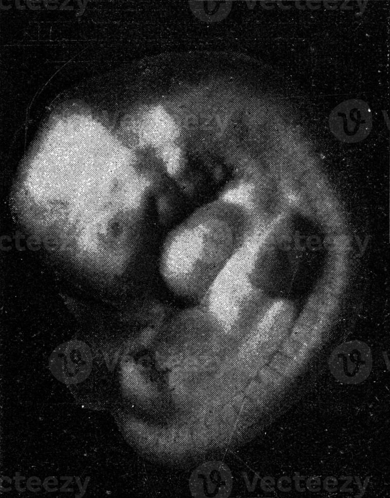 menselijk embryo, wijnoogst gravure. foto