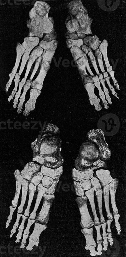 skelet van de Rechtsaf voet en de links voet van de Mens, wijnoogst gravure. foto