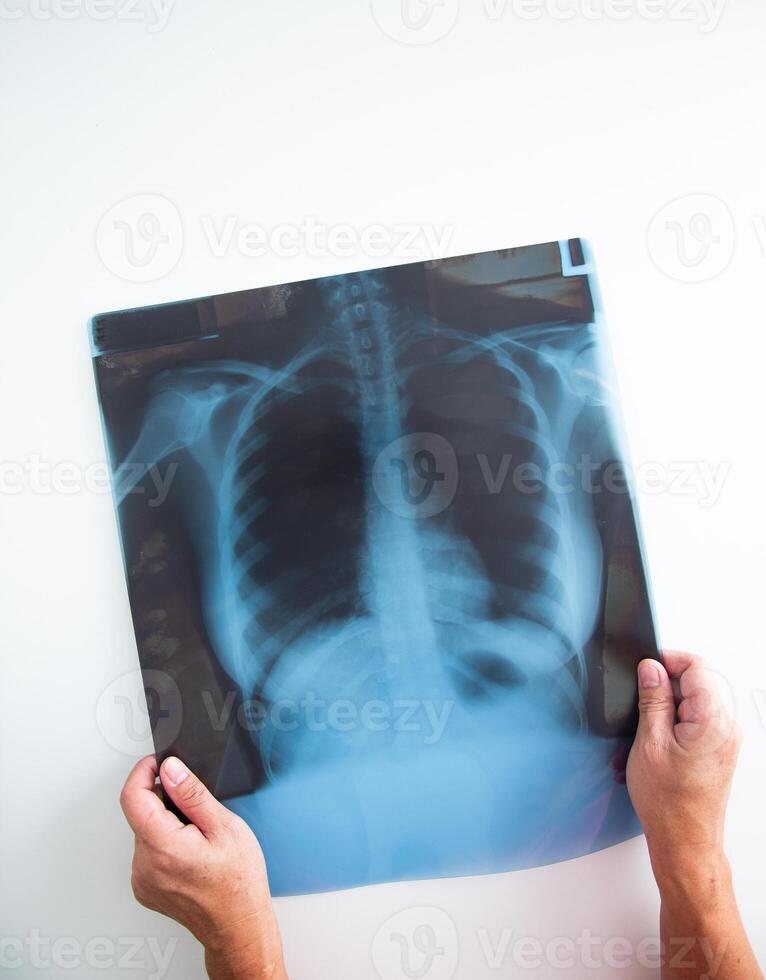 medisch dokter hand- Holding een X straal afbeelding. foto