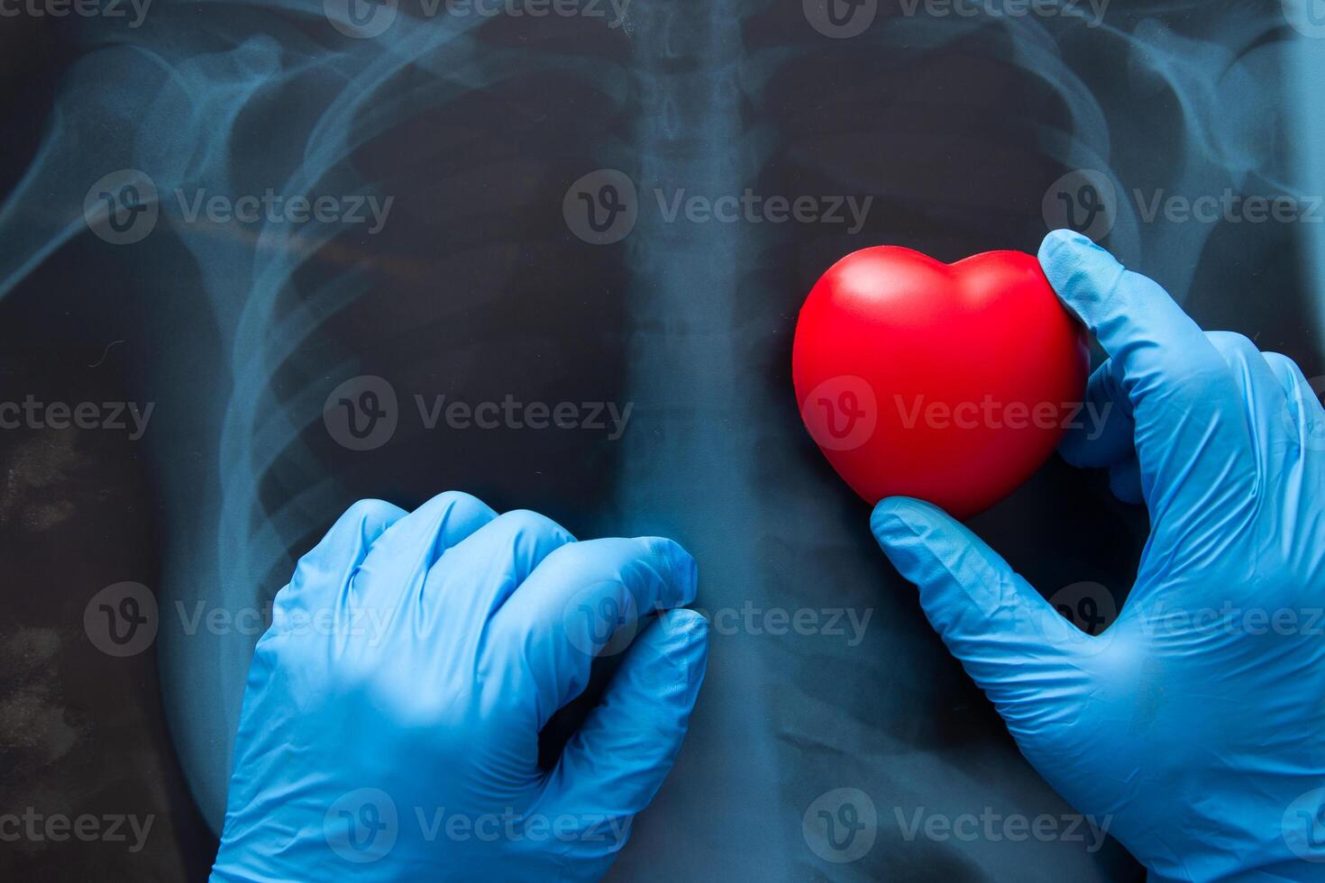 rood hart Aan X straal borst. foto