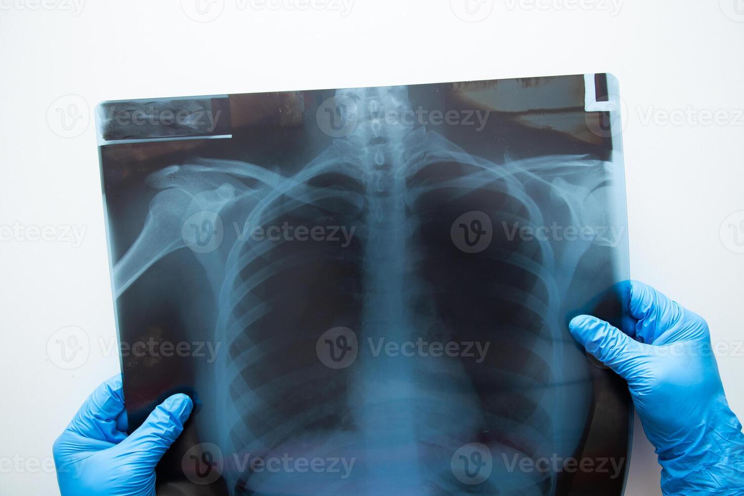 medisch dokter hand- Holding een X straal afbeelding. foto