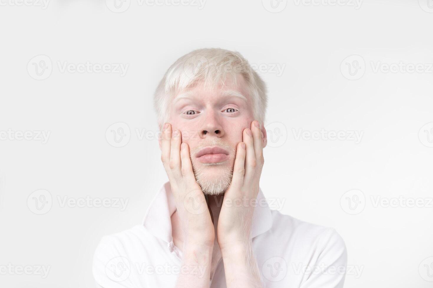 portret van een albino Mens in studio gekleed t-shirt geïsoleerd Aan een wit achtergrond. abnormaal afwijkingen. ongebruikelijk uiterlijk foto