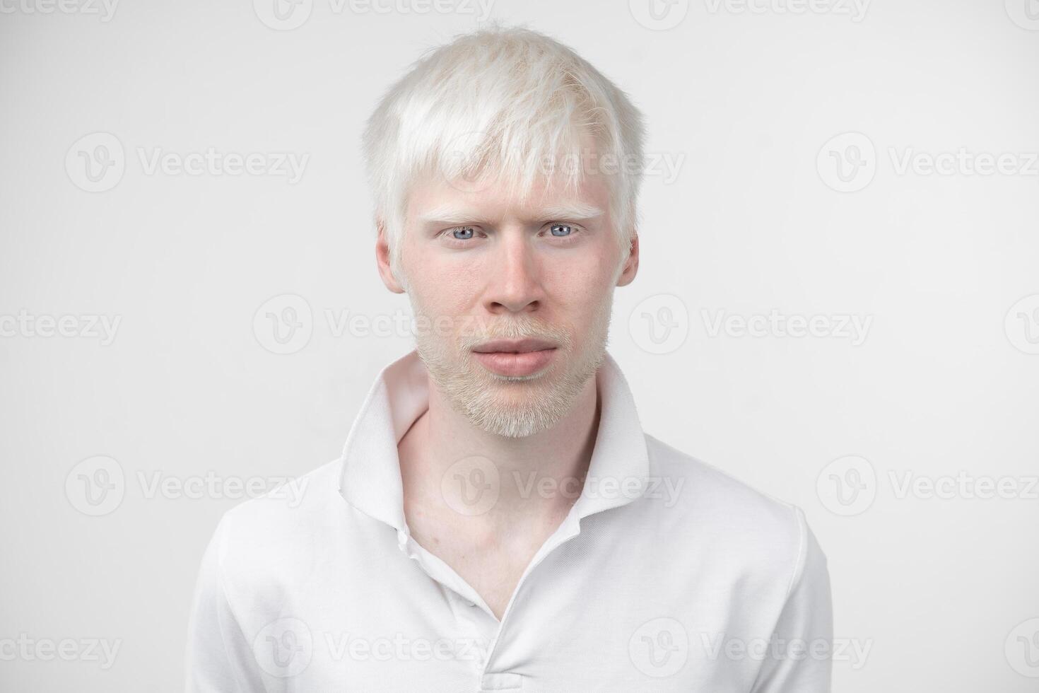 portret van een albino Mens in studio gekleed t-shirt geïsoleerd Aan een wit achtergrond. abnormaal afwijkingen. ongebruikelijk uiterlijk foto