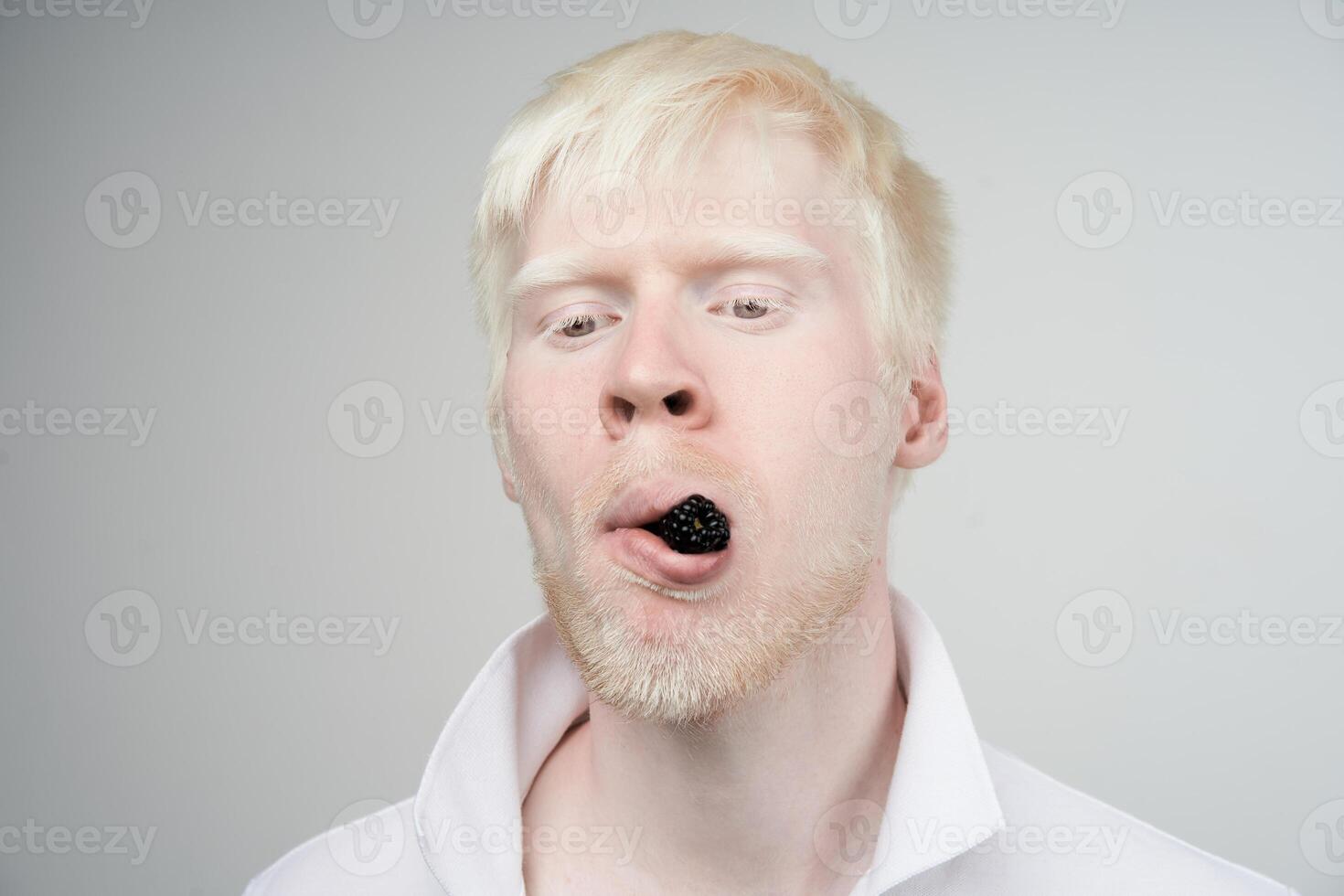 albinisme albino Mens in studio gekleed t-shirt geïsoleerd Aan een wit achtergrond. abnormaal afwijkingen. ongebruikelijk uiterlijk foto