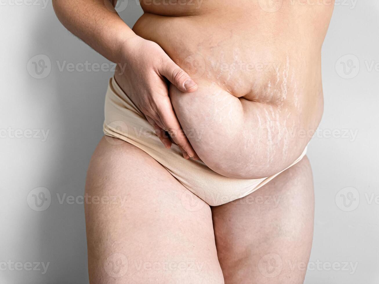postpartum dames buik tonen rekken merken, lichaam positiviteit en echt post zwangerschap veranderingen concept. foto
