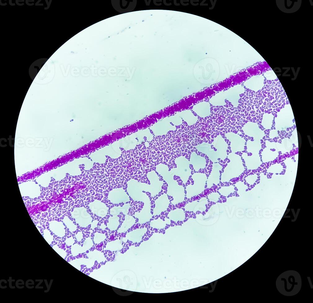 pus gram gebrandschilderd microscopisch tonen gram positief bacteriën. foto