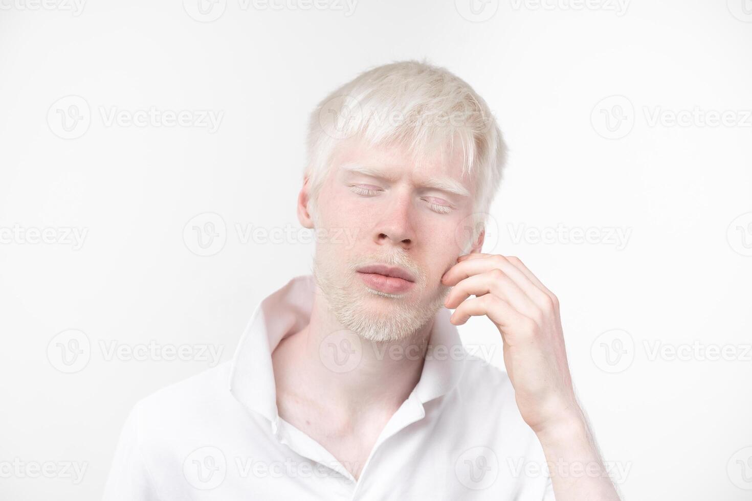 portret van een albino Mens in studio gekleed t-shirt geïsoleerd Aan een wit achtergrond. abnormaal afwijkingen. ongebruikelijk uiterlijk foto