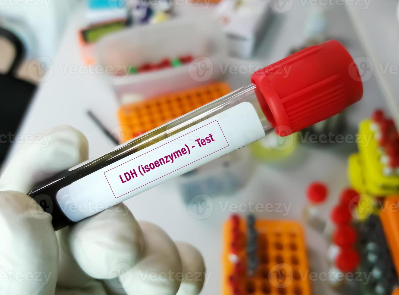 bloedmonster voor ldh - isoenzymtest. actaatdehydrogenase, diagnose voor cellulaire vernietiging of weefselbeschadiging. foto