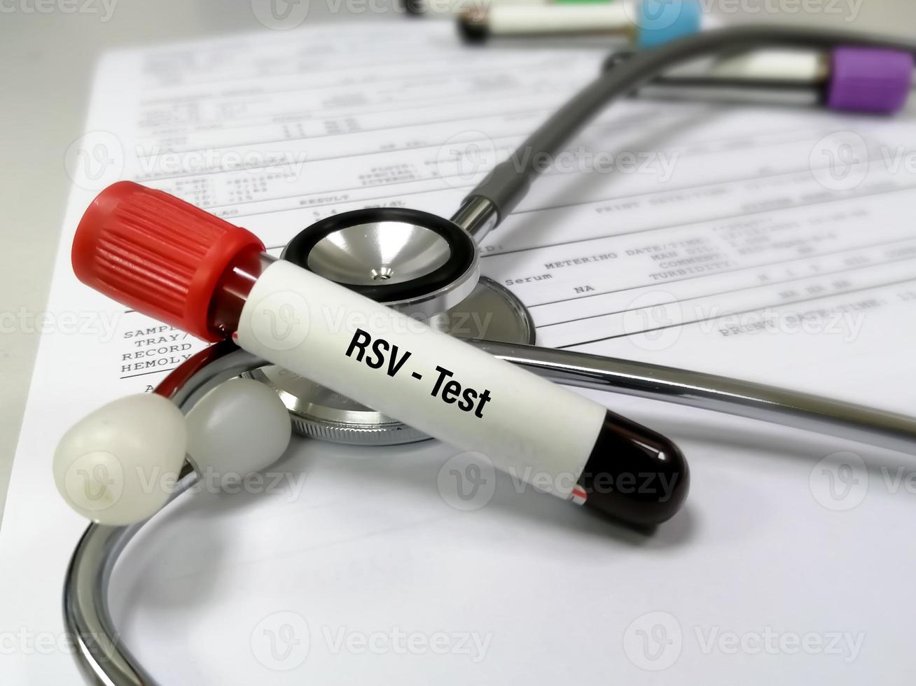 bloedmonster voor respiratoire syncytia-test. rsv foto