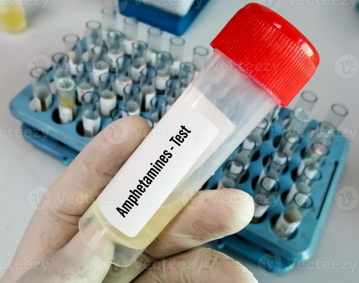 wetenschapper houdt urinemonster vast voor amfetamine-drugstest. drugstest is een technische analyse van het monster om illegaal drugsmisbruik als amfetamine te bepalen foto