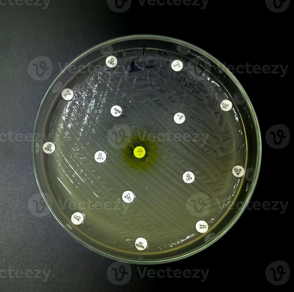 antimicrobiële gevoeligheidstesten in petrischaaltjes. antibioticaresistentie van bacteriën foto