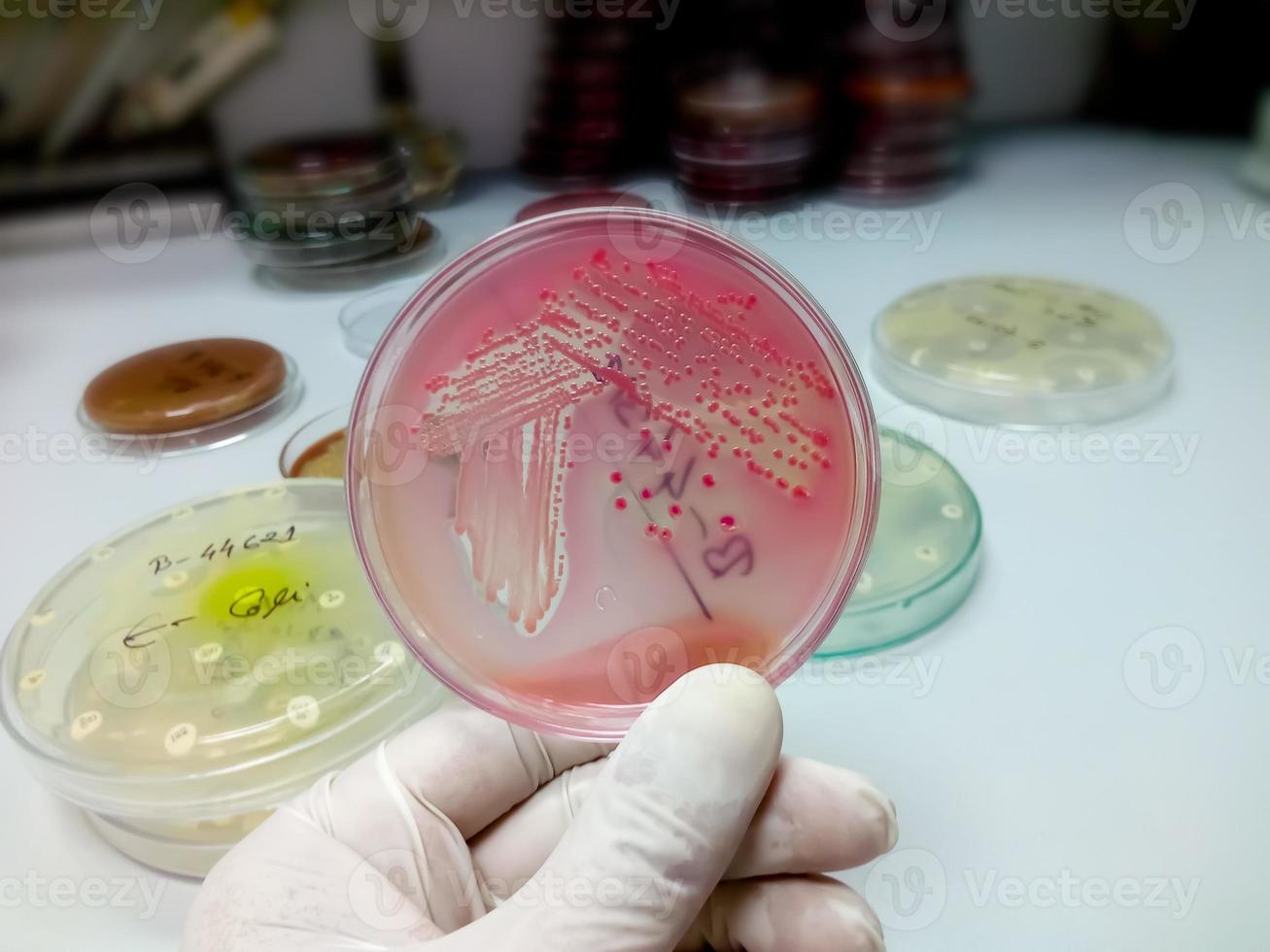 kolonies van bacteriën in macconkey-agar. kweekmedium plaat. petrischaal foto