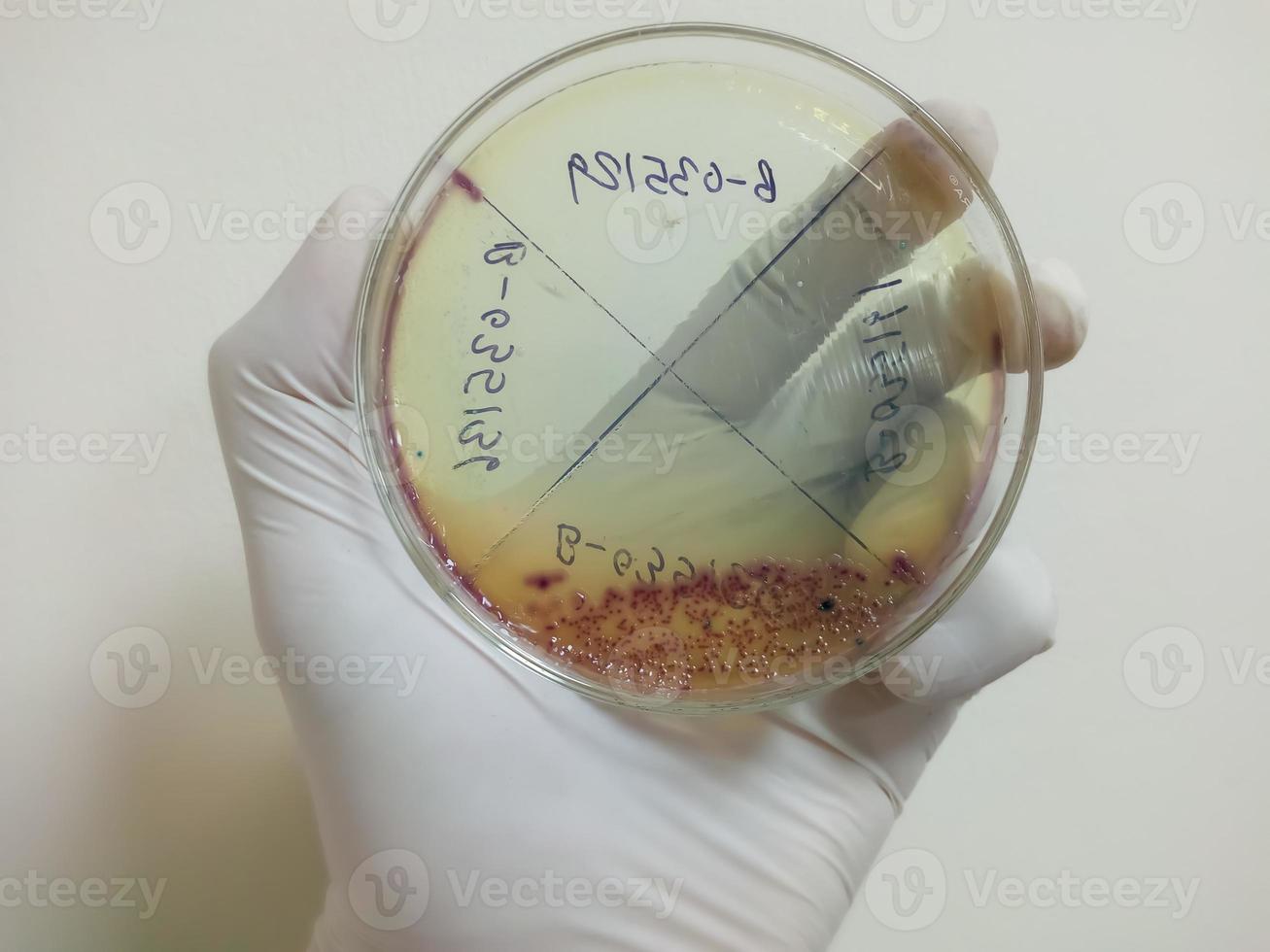 wetenschapper of technoloog houdt een kweekmediaplaat in het laboratorium. petrischaal van urinecultuur in de microbiologie. detailopname. e. coli foto
