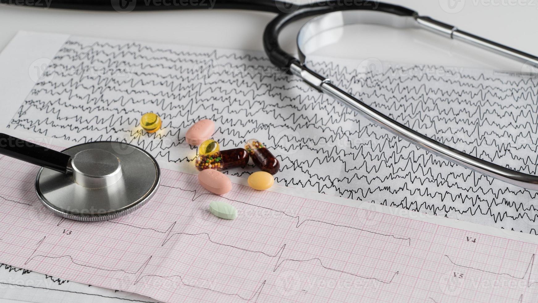 medische stethoscoop met pillen en cardiogram foto