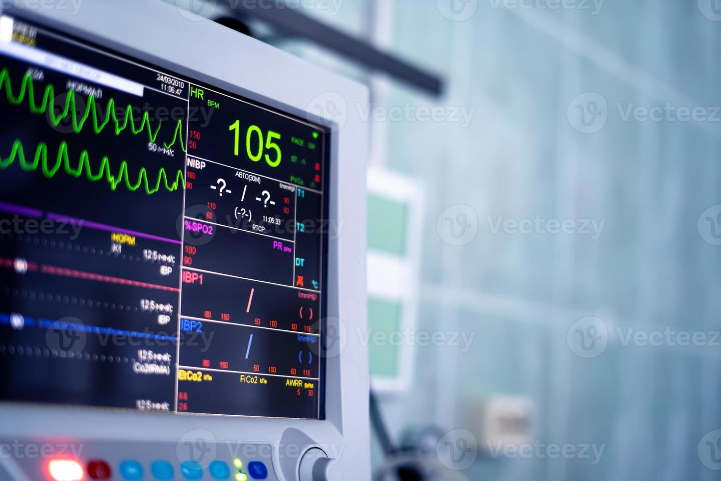 hartmonitorscherm in de ziekenhuiskamer foto