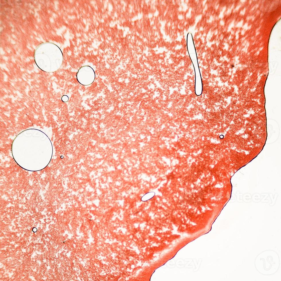 bloeduitstrijkje onder microscoop aanwezige neutrofielen en rode bloedcellen. fotomicrosecties met hoge vergroting met lichtmicroscoop foto