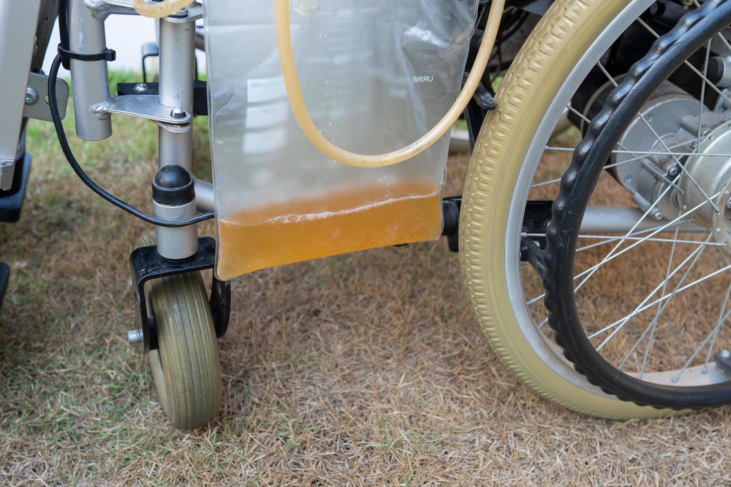 Aziatische dame patiënt zittend op rolstoel met urine katheter drainage zak in ziekenhuisafdeling, gezond medisch concept. foto