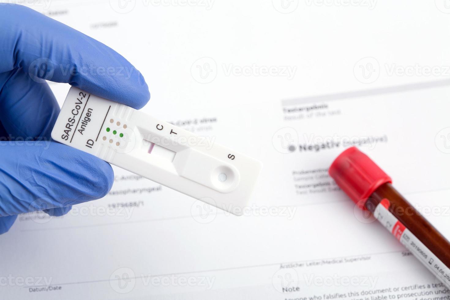 negatief testresultaat door gebruik van sneltestapparaat voor covid-19. foto