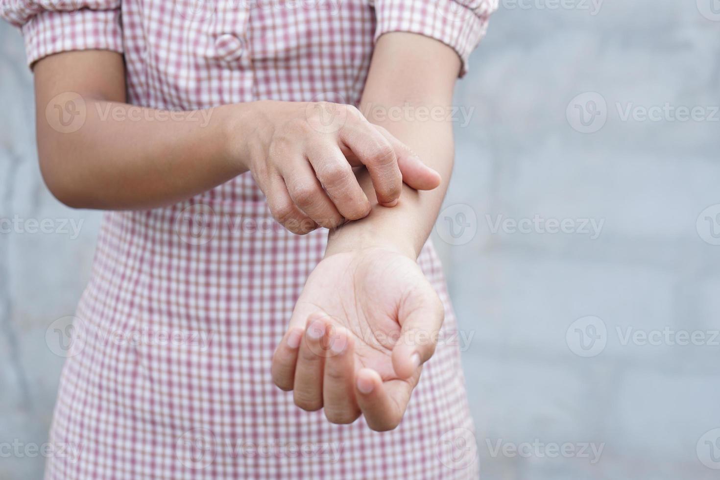 vrouw krabt arm van jeuk op grijze achtergrond foto