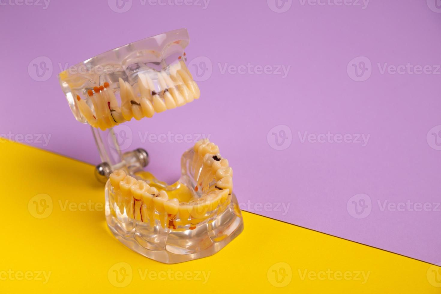 tandartshulpmiddelen en kunstmatige kaak op heldere gele en violette achtergrond. foto