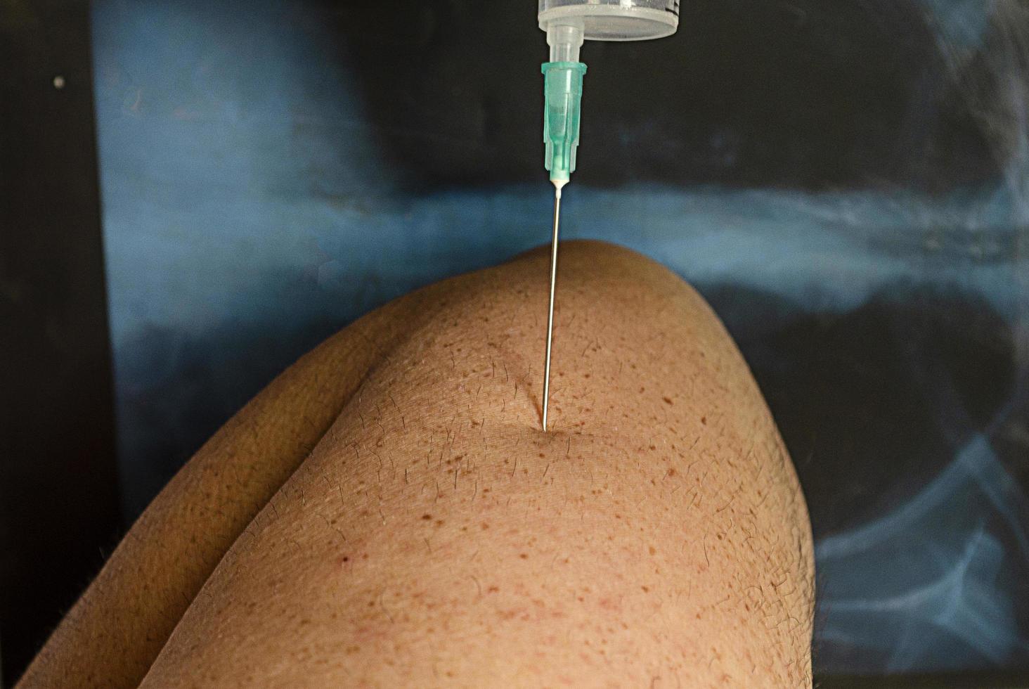 de naald van de spuit met het virusvaccin wordt dicht bij de arm van de patiënt geplaatst. foto