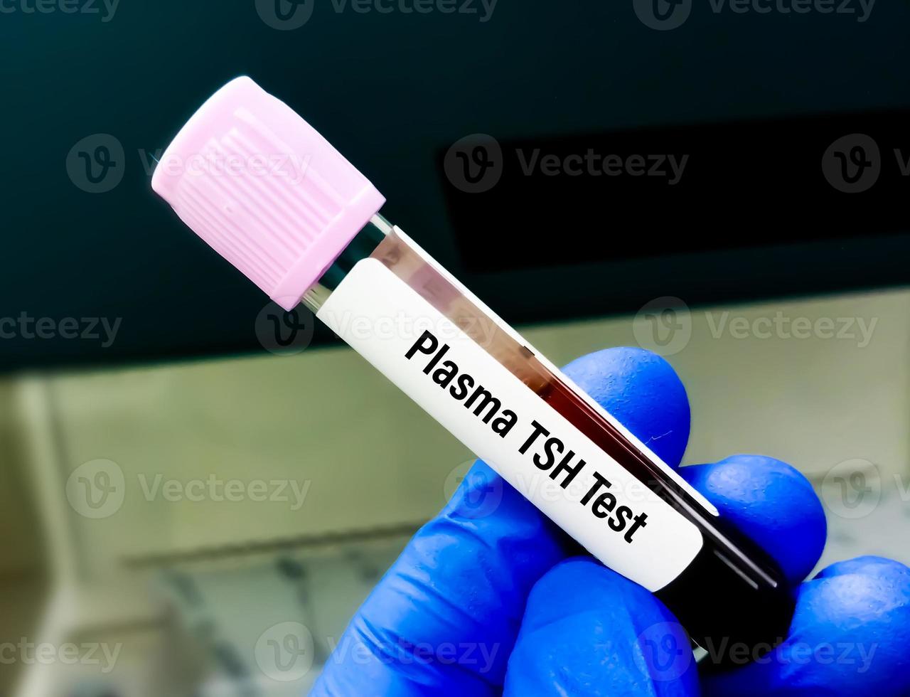 bloedmonster voor plasma-tsh-test voor diagnose van schildklierziekte. foto