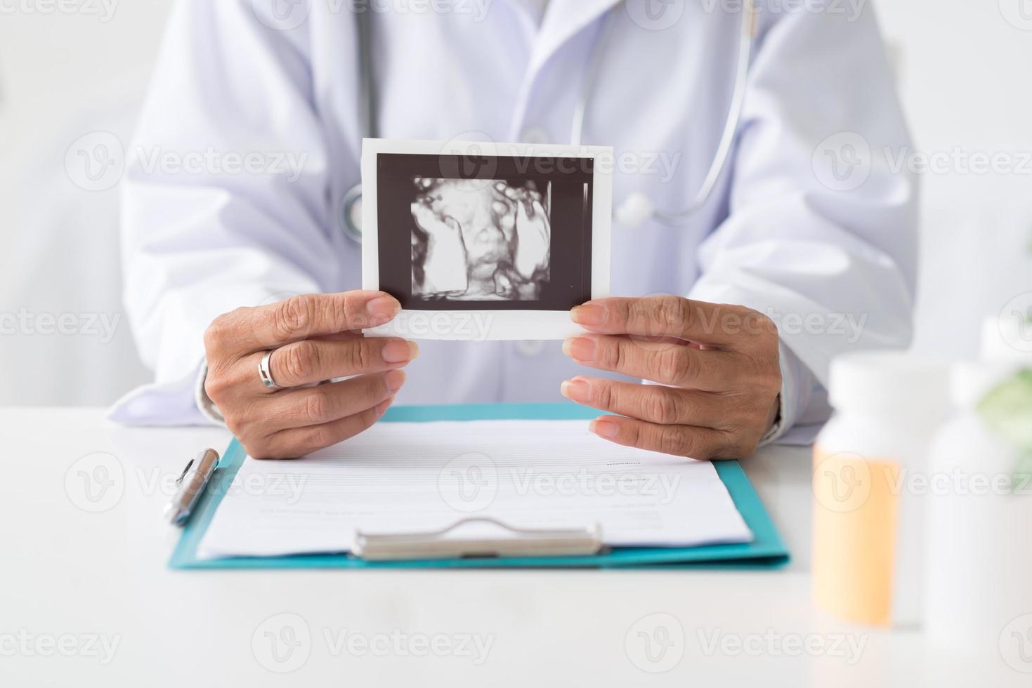 met ultrageluidscanfoto van baby foto