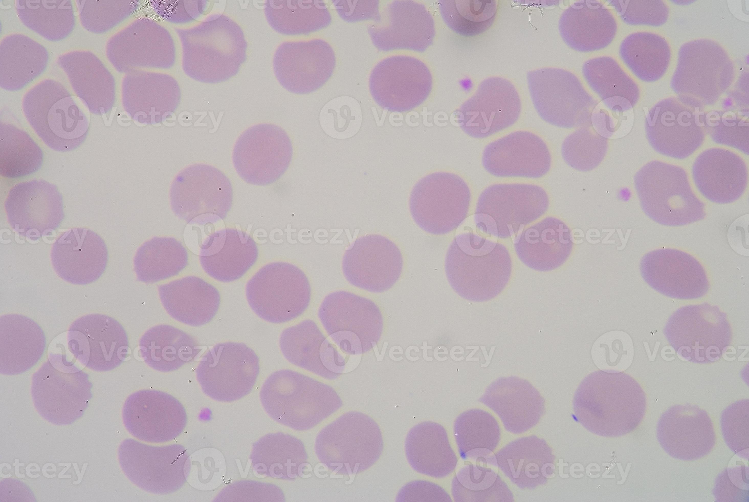 rode bloedcellen vormen macrocytose. foto