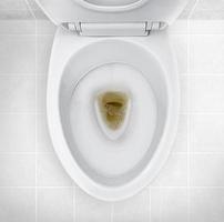 badkamer toilet met donker gekleurde urine foto