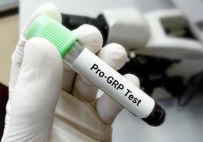 bloed monster voor pro-gp of gastrine-vrijgevend peptide testen, markeerstift voor klein cel long kanker. foto