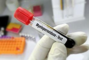 bloed monster voor myeloperoxidase test met wazig laboratorium achtergrond. foto