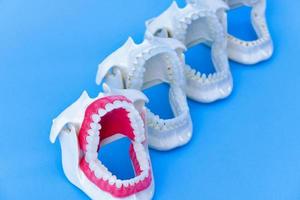 tandarts orthodontisch tanden modellen foto