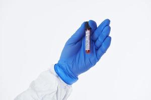 coronavirus, dokter Holding positief covid-19 virus bloed monster buis wit achtergrond foto