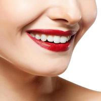 vrouw glimlach. tanden bleken. tandheelkunde. foto