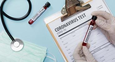 hand- Holding testen patiënten bloed monsters voor coronavirus het uitbreken covid-19 in de laboratorium met dokter medisch apparatuur, nieuw coronavirus 2019-ncov van wuhan China concept, geïsoleerd lang banier foto