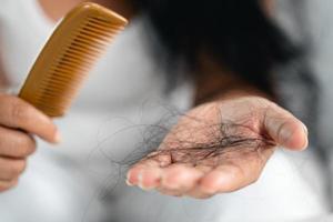 haaruitval probleem. aziatische vrouw met kam en haarprobleem. haaruitval door kam. haarverzorging en schoonheidsconcepten. foto