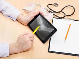dokter onderzoekt röntgenstraal afbeelding van menselijk knie gewricht foto