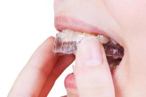 vrouw reparaties Doorzichtig uitlijner Aan tanden geïsoleerd foto
