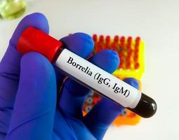 wetenschapper Holding bloed monster buis voor borrelia igg en igm testen, Lyme ziekte diagnose. foto