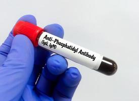 bloed monster voor anti fosfatidyl antilichaam testen. foto