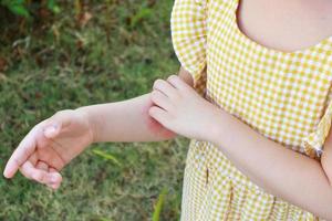 weinig meisje heeft huid uitslag allergie en jeukend Aan haar arm foto