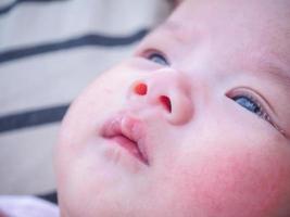 pasgeboren baby met allergie Aan gezicht foto