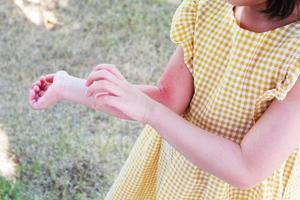 weinig meisje heeft huid uitslag allergie en jeukend Aan haar arm foto