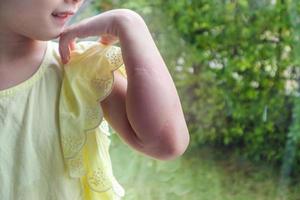 weinig meisje heeft huid uitslag allergie en jeukend Aan haar arm foto