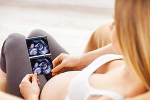 zwanger vrouw met röntgenstraal afbeelding. top visie van mooi zwanger vrouw zittend Aan de stoel en Holding röntgenstraal beeld van haar baby foto