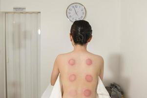 mooi vrouw ontvangen cupping behandeling Aan terug door therapeut, Chinese geneeskunde behandeling, Gezondheid en genezing concept. foto