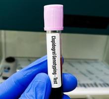 clopidogrel pcr genotypering testen. cyp2c19 gen testen. polymerase keten reactie. foto