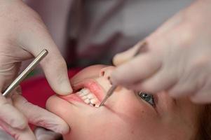 behandeling van baby tanden in een kind, een bezoek naar de tandarts. foto