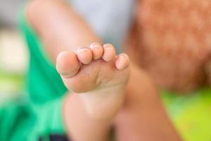 baby voeten en tenen hebben littekens Aan de tenen foto